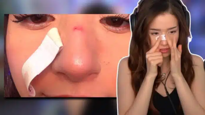pokimane nose cut